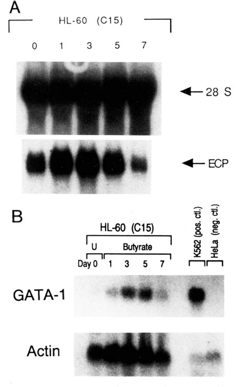 Figure From Expression Of Mrna For The Gata Binding Proteins In Human