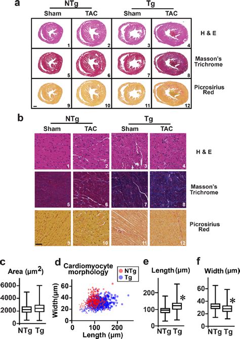 Immunohistochemistry Of Cardiac Sections And Adult Cardiomyocyte