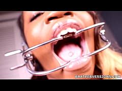 Mouth Spreader On A Beautiful Ebony Babe Xxx Mobile Porno Videos Movies IPornTV Net