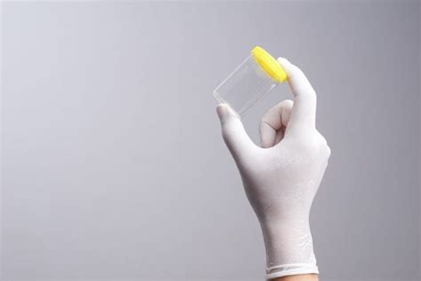 What Does Urine Color Indicate? - Facty Health