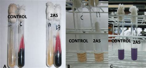 Lysine Decarboxylase Test