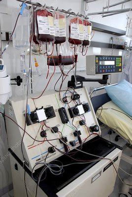 Apheresis machine - Stock Image - C002/5497 - Science Photo Library