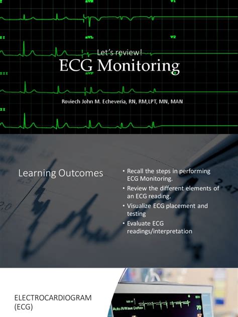 Ecg Monitoring | PDF | Electrocardiography | Medical Imaging