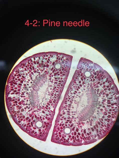 Lab 4 Pine Needle Cross Section Diagram Quizlet