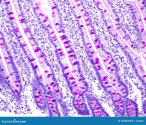 Small Intestine Section Under The Microscope Stock Photography