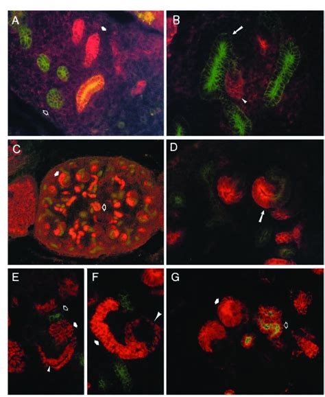 Immunocytochemistry Of Ecadherin And Cadherin 6 In The Embryonic