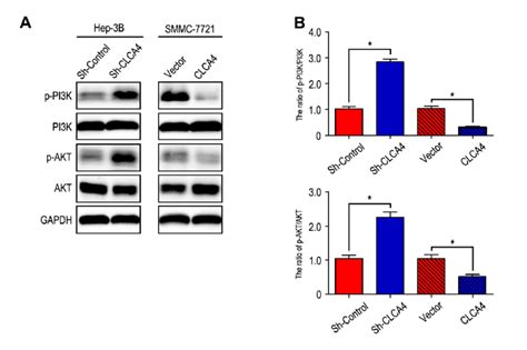 CLCA4 Inhibits HCC Cell Migration Invasion And EMT Through Suppressing