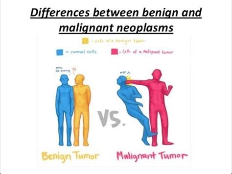 Tumor Types Benign Malignant Explained Briefly Youtube