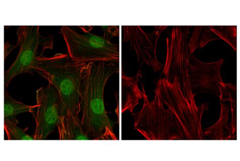 Phospho P44 42 MAPK Erk1 2 Thr202 Tyr204 D13 14 4E XP Rabbit MAb