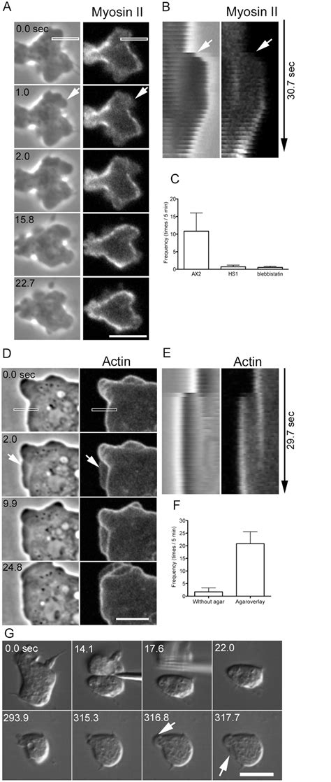 Cortical Tension Powered By Myosin Ii Is Required For Blebbing A A