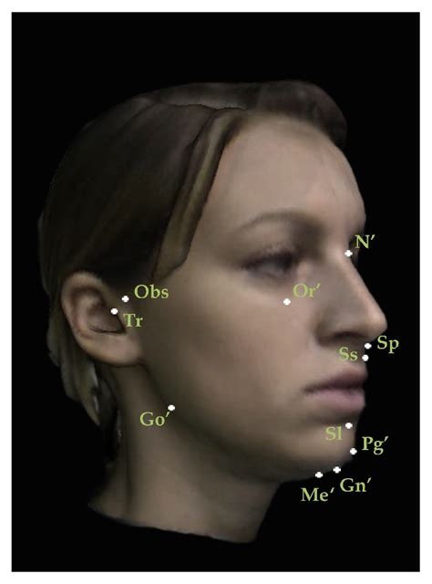 Correlation Assessment Between Three Dimensional Facial Soft Tissue