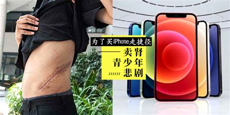 【男人】【9年前“卖肾买iphone”青少年超坎坷，如今依然卧床不起终身成了伤残人士！】据悉价格为rm13000。