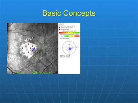 Introduction to Microperimetry - YouTube