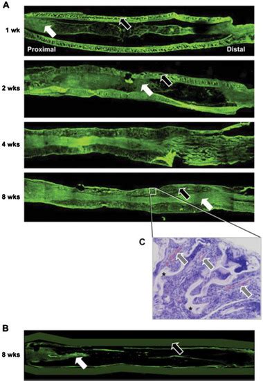 Gels Free Full Text Poloxamer Based Scaffolds For Tissue