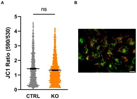 Cells Free Full Text Impact Of Translocator Protein Kda Tspo