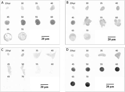 Development Of P Berghei Parasites Individual Parasites Were Followed Download Scientific