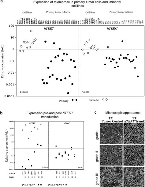 Tert Induced Immortalization Of Primary Breast Tumor Cells A Htert