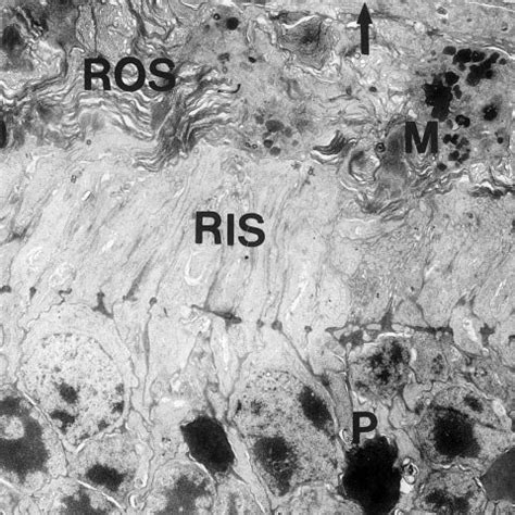 Light Treated Rcs Rat At P Peripheral Retina Normal Morphology Of