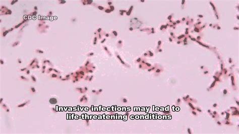 Fusobacterium And Infections Youtube