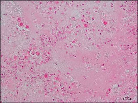 Histopathology of gizzard from 18-day-old broiler chicken (flock D1 ...