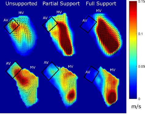 Steady Streaming Analysis Time Averaged Mean Velocities Of Two Hearts