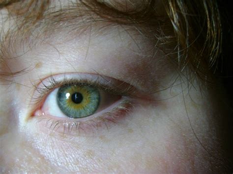 Central Heterochromia II by thelifestream on DeviantArt