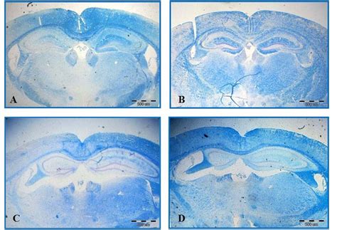 Luxol Fast Blue Staining Significant Differences Are Observed Among Download Scientific