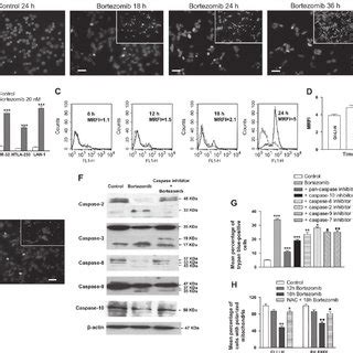 Effect Of Bortezomib On Induction Of Apoptosis In Neuroblastoma Cells