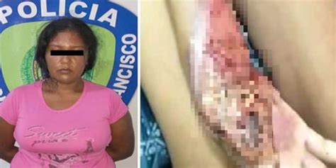 De Terror Le Quem La Mano A Su Hija Y Le Mutil Un Dedo Por Comerse