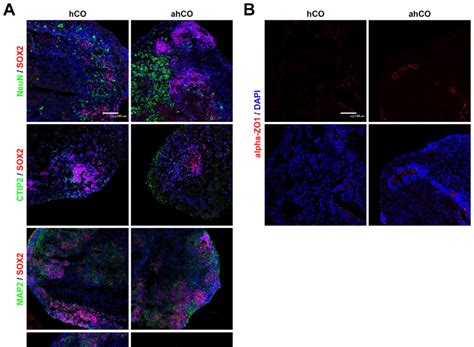 Neuronal Characterization Of Cerebral Organoids A Representative