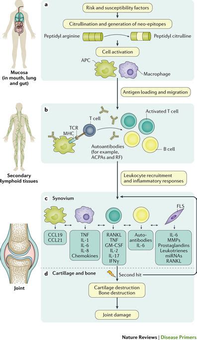 Nature Reviews Disease Primers On Twitter Rheumatoid Arthritis Is A