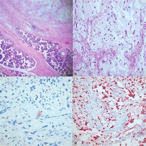 Photomicrographs A 40Â B100Â Hematoxylin Eosin Stain Shows Download Scientific Diagram