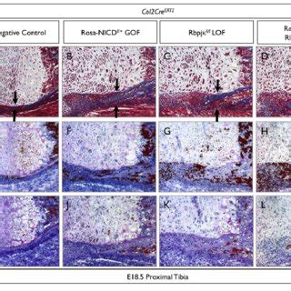 Loss Of RBPj Dependent Notch Signaling In Both Chondrogenic And