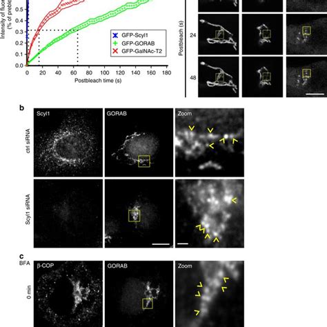 GORAB Co Localizes With Scyl1 And COPI In Discrete Domains At The