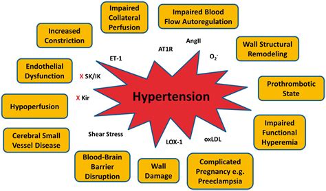 The Importance Of Comorbidities In Ischemic Stroke Impact Of