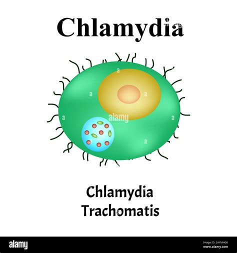 Chlamydia Trachomatis Infecciones Bacterianas Clamidiosis