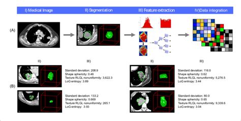 Radiomics Approach A Workflow Of Extracting Radiomic Features I A Download Scientific