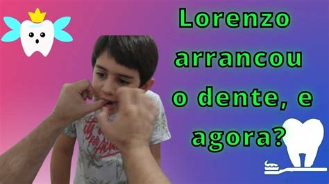 Lorenzo Arrancou O Dente E Agora Perdi Meu Dente Dentedeleite