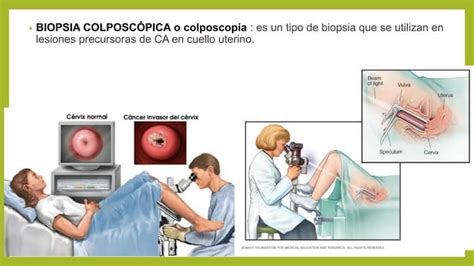 Patologia M Dica Biopsia Y Autopsia Pptx