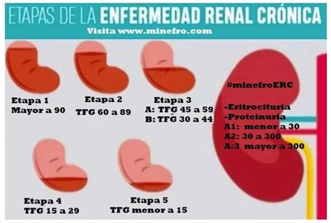 ENFERMEDAD RENAL CRÓNICA MAS VALE PREVENIR QUE DIALIZAR ACUDE AL