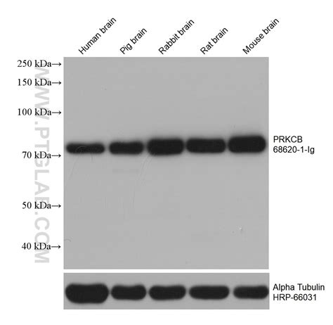 Prkcb Antibody Pbs Proteintech