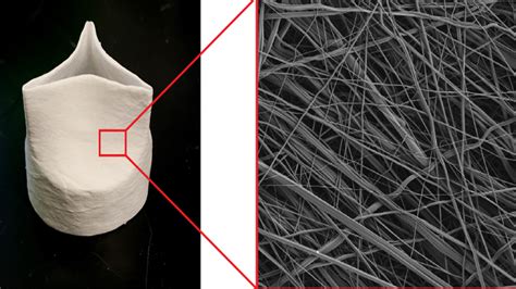 3d Printed Heart Valve