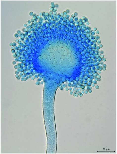 Aspergillus Flavus Under Microscope