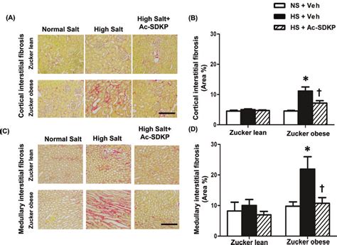 Effect Of Ac Sdkp On Renal Cortical And Medullary Interstitial Fibrosis