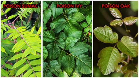 Poison Oak Vs Poison Ivy Rash