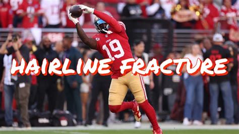 49ers WR Deebo Samuel To Miss At Least The Next 2 Games With A