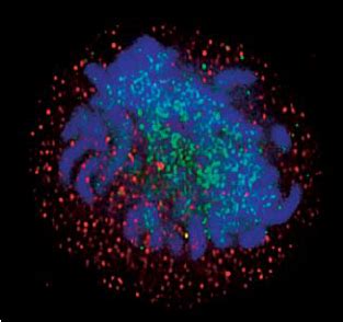 SIRT 1 Deacetylasethe Human Enzyme That Promotes Cell Survivalin A