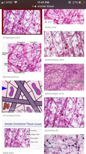 Tissue Identification Flashcards Quizlet