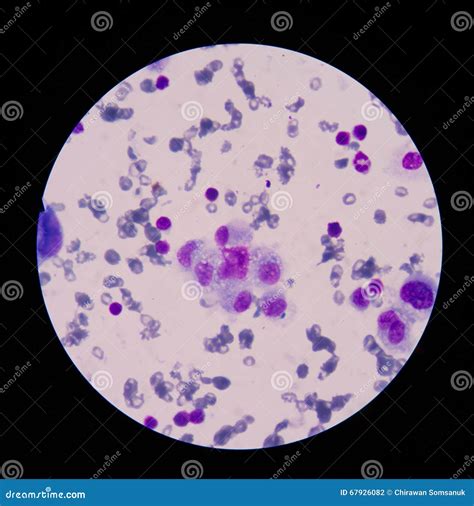 Mesothelial cells stock photo. Image of cancer, dermatology - 67926082