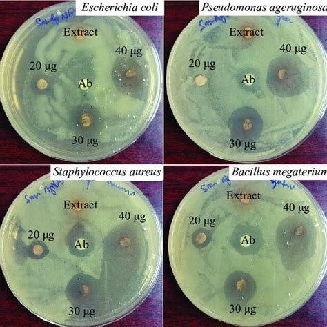 Antibacterial Activity Of Sm Agnps Download Scientific Diagram